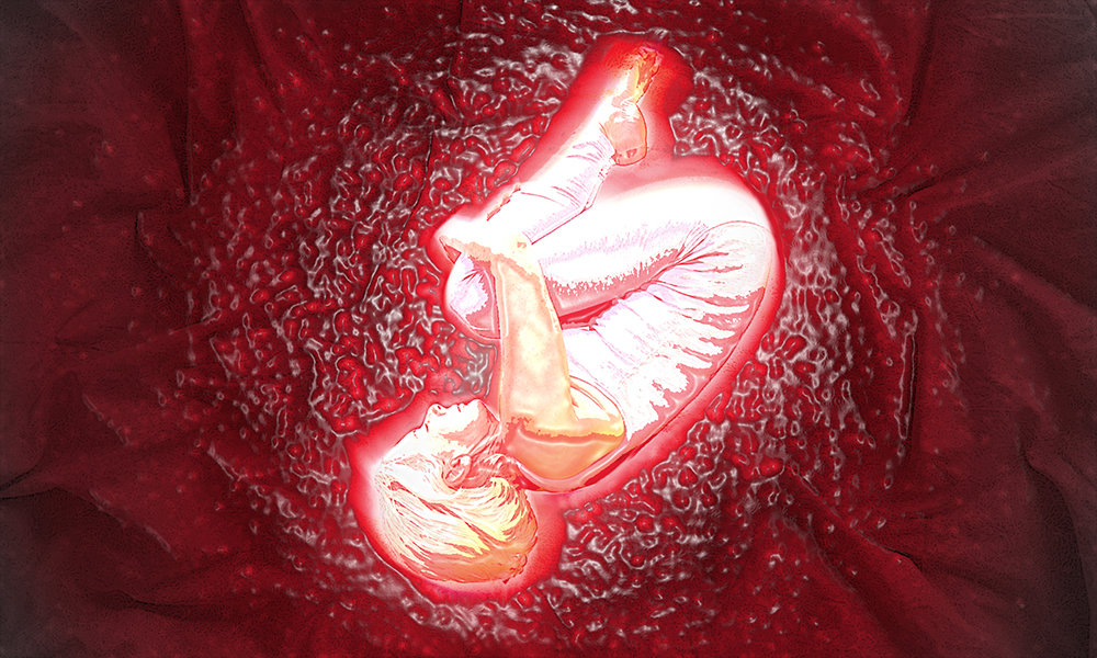 Story image for Embryo by Story image for Embryo by